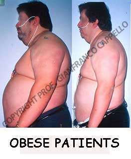 Obese